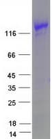 Human MYBPC3 / MYBP-C Protein (Recombinant Myc-DDK (Flag))