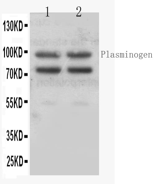 PLG / Plasmin / Plasminogen Antibody (aa103-352)