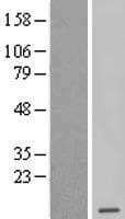 SEPX1 / Selenoprotein R (Over-Expression Lysate Myc-DDK (Flag))