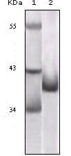 Monoclonal Mouse anti-Rat p16INK4a / CDKN2A Antibody (clone 1E12E10, IHC, WB)