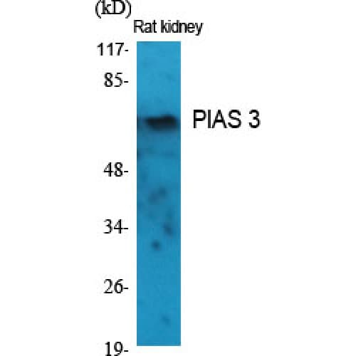 PIAS3 Antibody (10-90 aa, N-terminal)