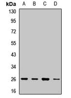 NAA10 / ARD1A Antibody