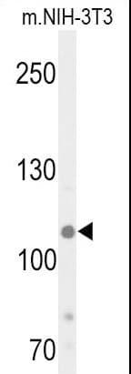 Polyclonal Rabbit anti-Human KDM4B / JMJD2B Antibody (Thr305, WB)