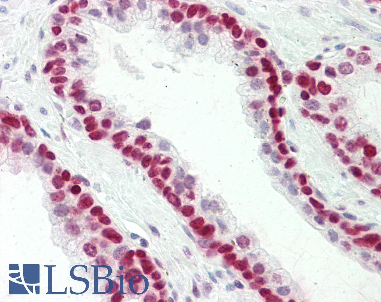 Polyclonal Rabbit anti-Human HMGN1 / HMG14 Antibody (C-Terminus, IHC, WB)