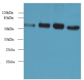 Polyclonal Rabbit anti-Human NUPL1 Antibody (aa211-480, IHC, WB)