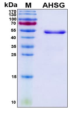 Human AHSG / Fetuin A Protein (Recombinant 6His, N-terminus)
