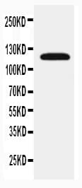 Polyclonal Rabbit anti-Human SLC12A1 / NKCC2 Antibody (aa125-139, IHC, WB)