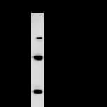 SATB2 Antibody (clone SATBA4B10)