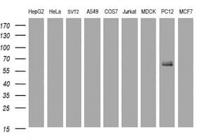 IHC-plus™ Monoclonal Mouse anti-Human KRT5 / CK5 / Cytokeratin 5 Antibody (clone OTI1C7, IHC, WB)