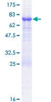 Human TASP1 Protein (Recombinant GST)