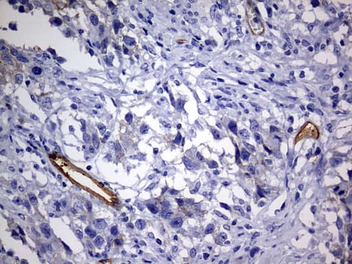 MCAM / CD146 Antibody (clone OTI2B2)