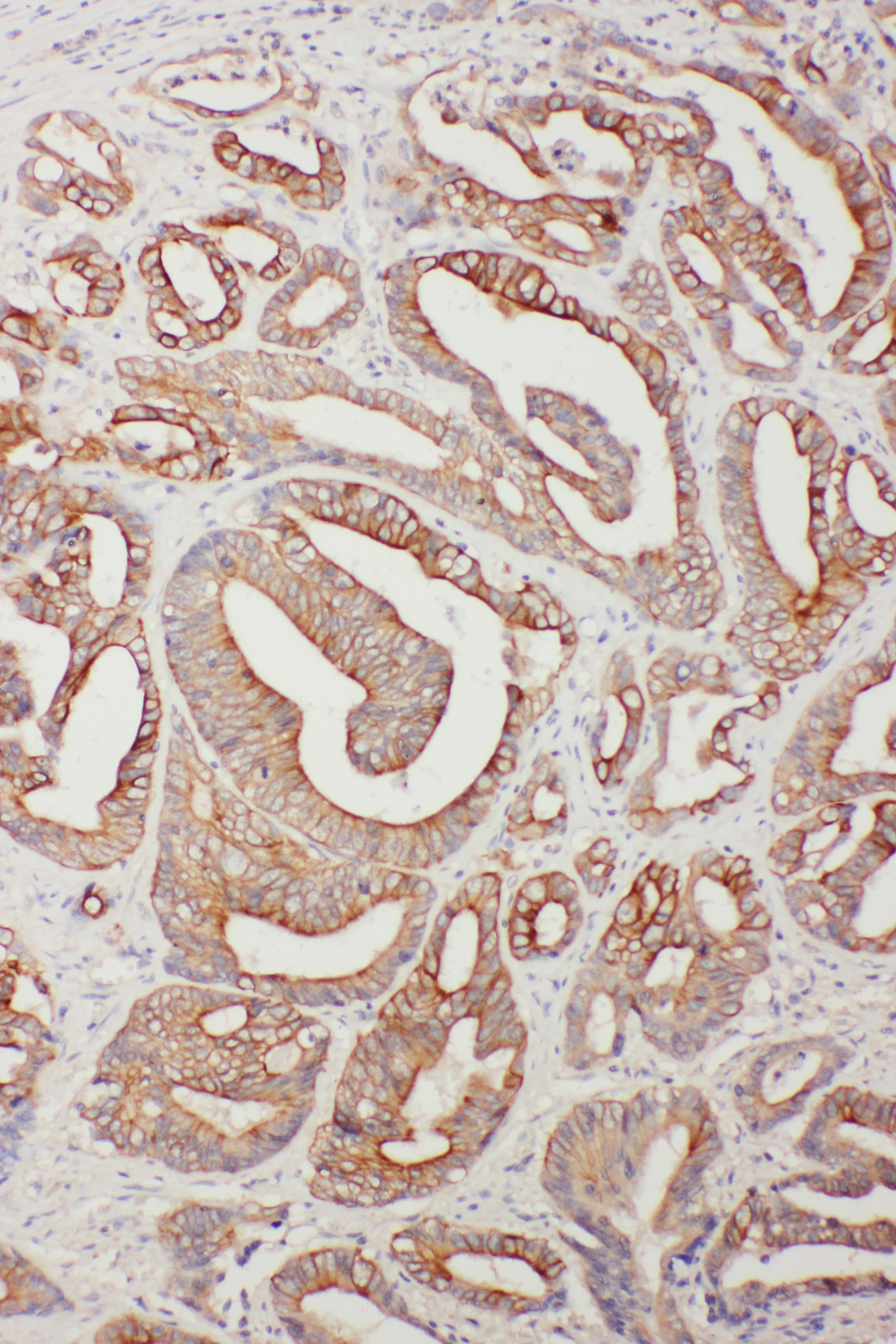 TNFAIP8L3 Antibody (aa273-292)