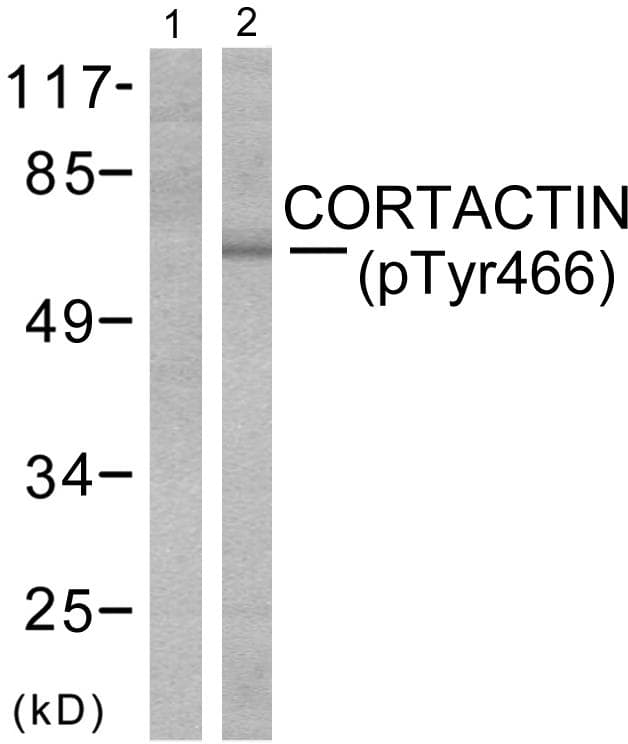 Polyclonal Rabbit anti-Human CTTN / Cortactin Antibody (phospho-Tyr466, IHC, WB)