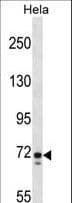 GALNT6 Antibody (aa552-579)
