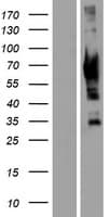 GRK7 / GPRK7 Protein (Over-Expression Lysate Myc-DDK (Flag))