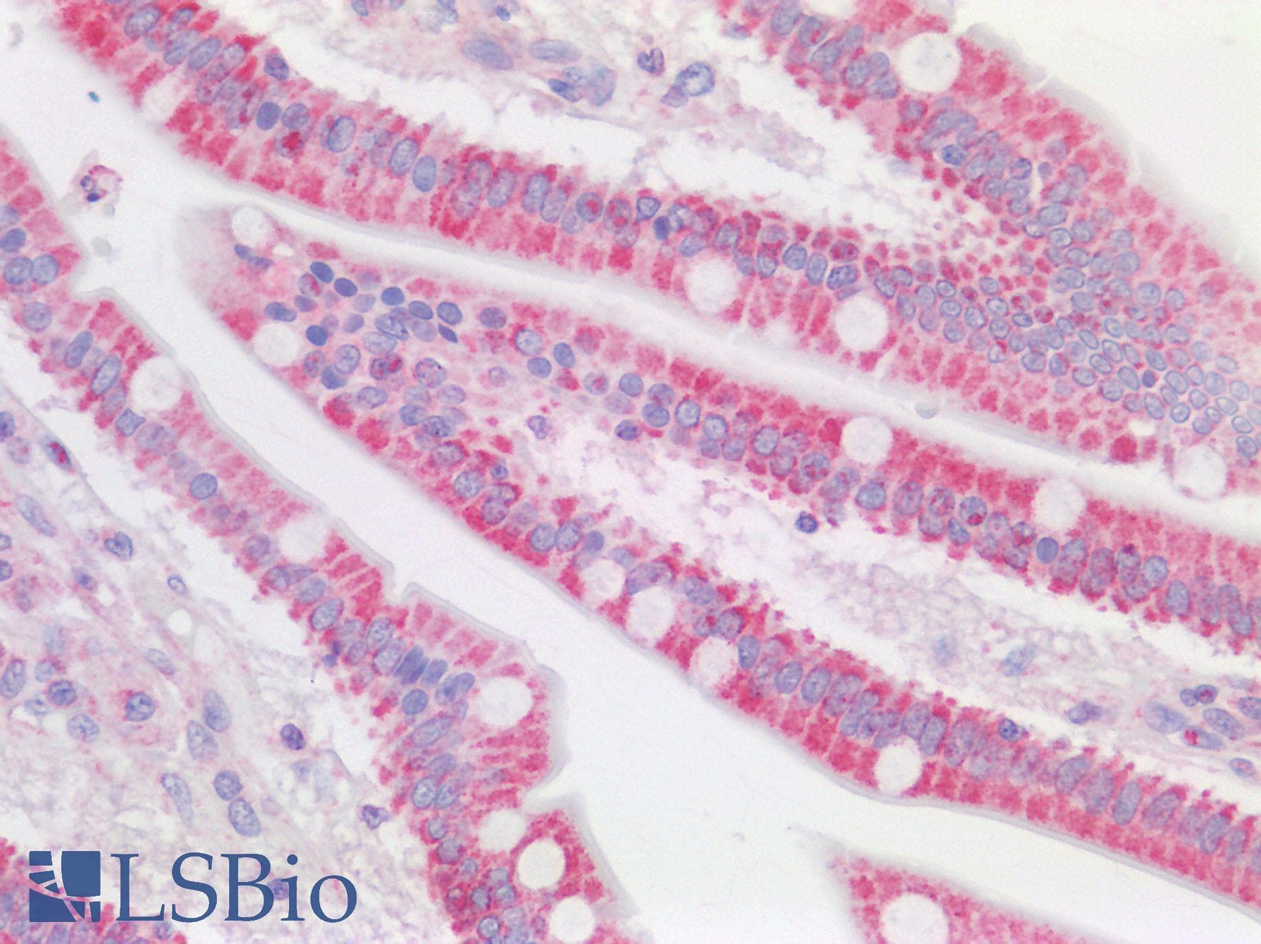 IHC-plus™ Polyclonal Rabbit anti-Human VDAC2 Antibody (N-Terminus, IHC)