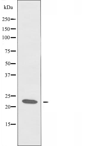 C6orf108 Antibody