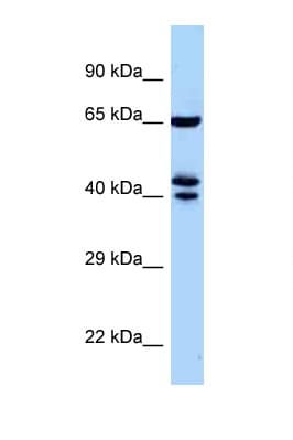 Polyclonal Rabbit anti-Mouse ZNF583 Antibody (aa271-320, WB)