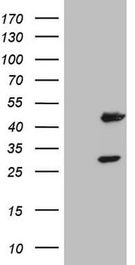 Monoclonal Mouse anti-Human NR1I3 / CAR Antibody (clone OTI2H10, aa1-236, WB)