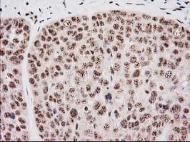 Monoclonal Mouse anti-Human MGLL / Monoacylglycerol Lipase Antibody (clone OTI1H1, IHC, IF, WB)