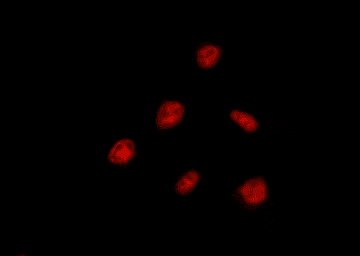 DDX52 Antibody