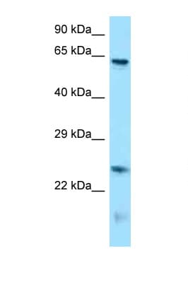 RUNX1T1 / ETO Antibody (N-Terminus)