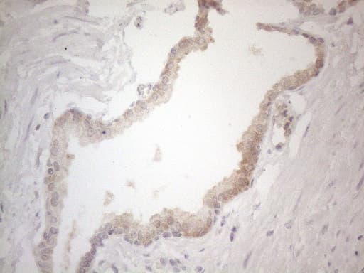 ZNF200 Antibody (clone OTI7C6)