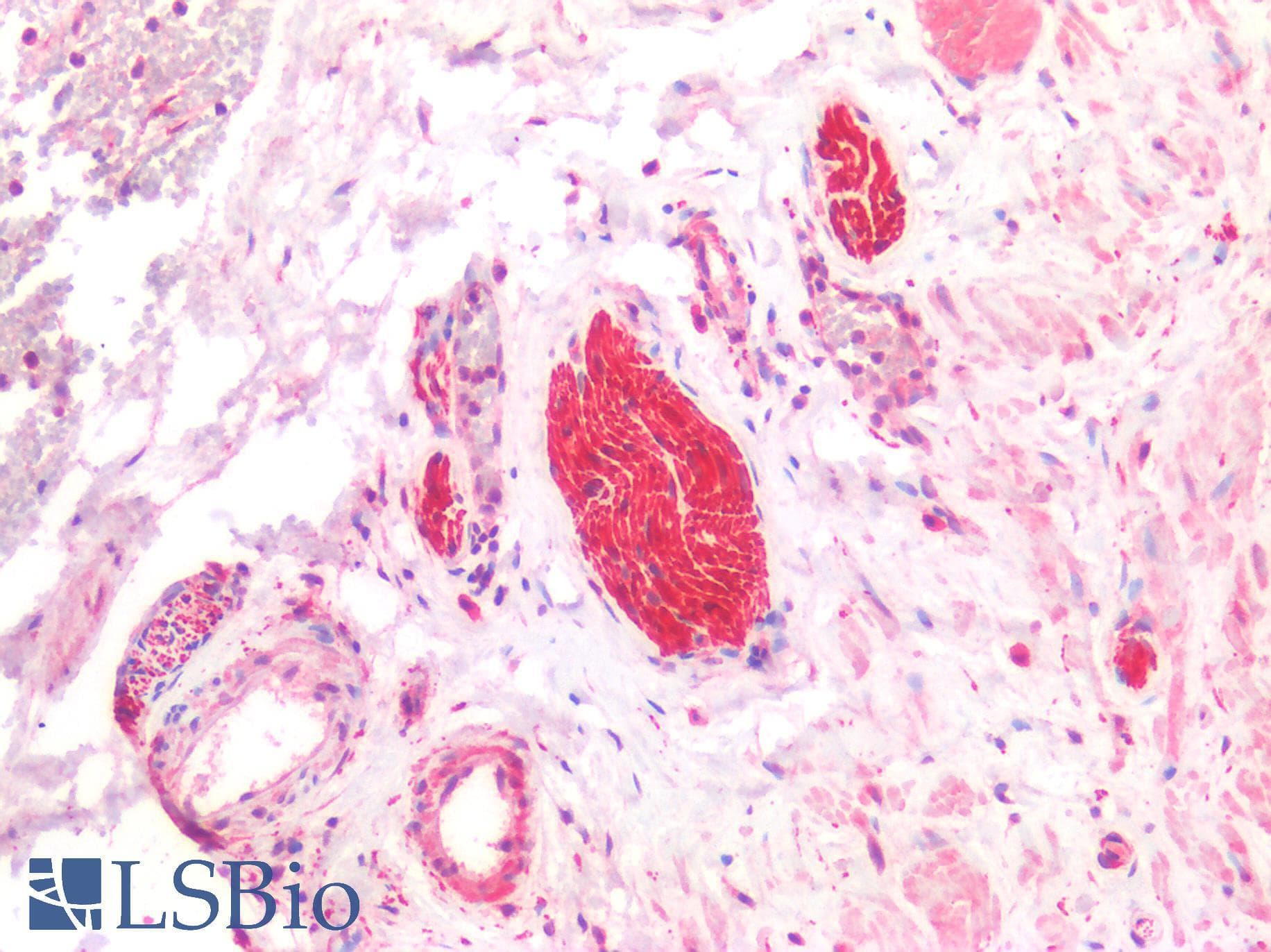 PathPlus™ UCHL1 / PGP9.5 Antibody
