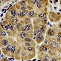 Polyclonal Rabbit anti-Human CETN1 Antibody (IHC, WB)
