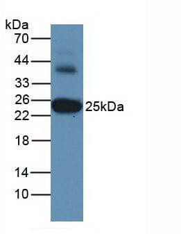 GSTA3 Antibody (aa1-222)