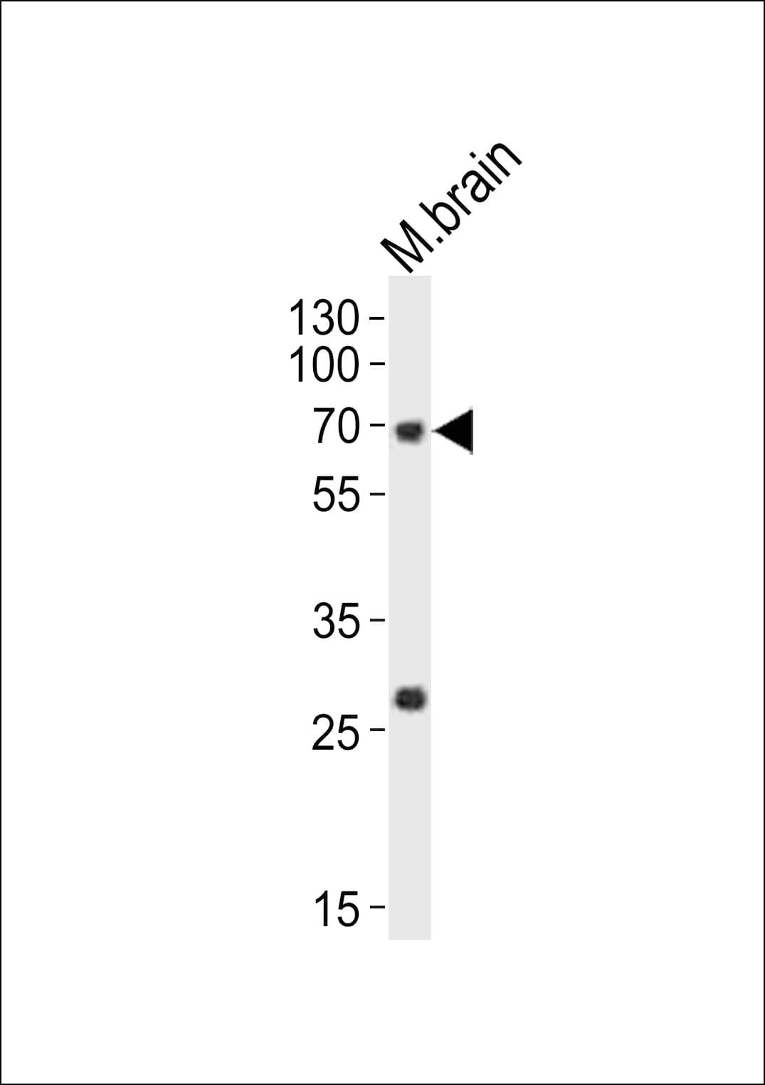 NACC1 / NAC1 Antibody (aa355-390)