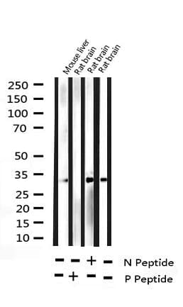 NPM1 / NPM / Nucleophosmin Antibody (phospho-Thr199)
