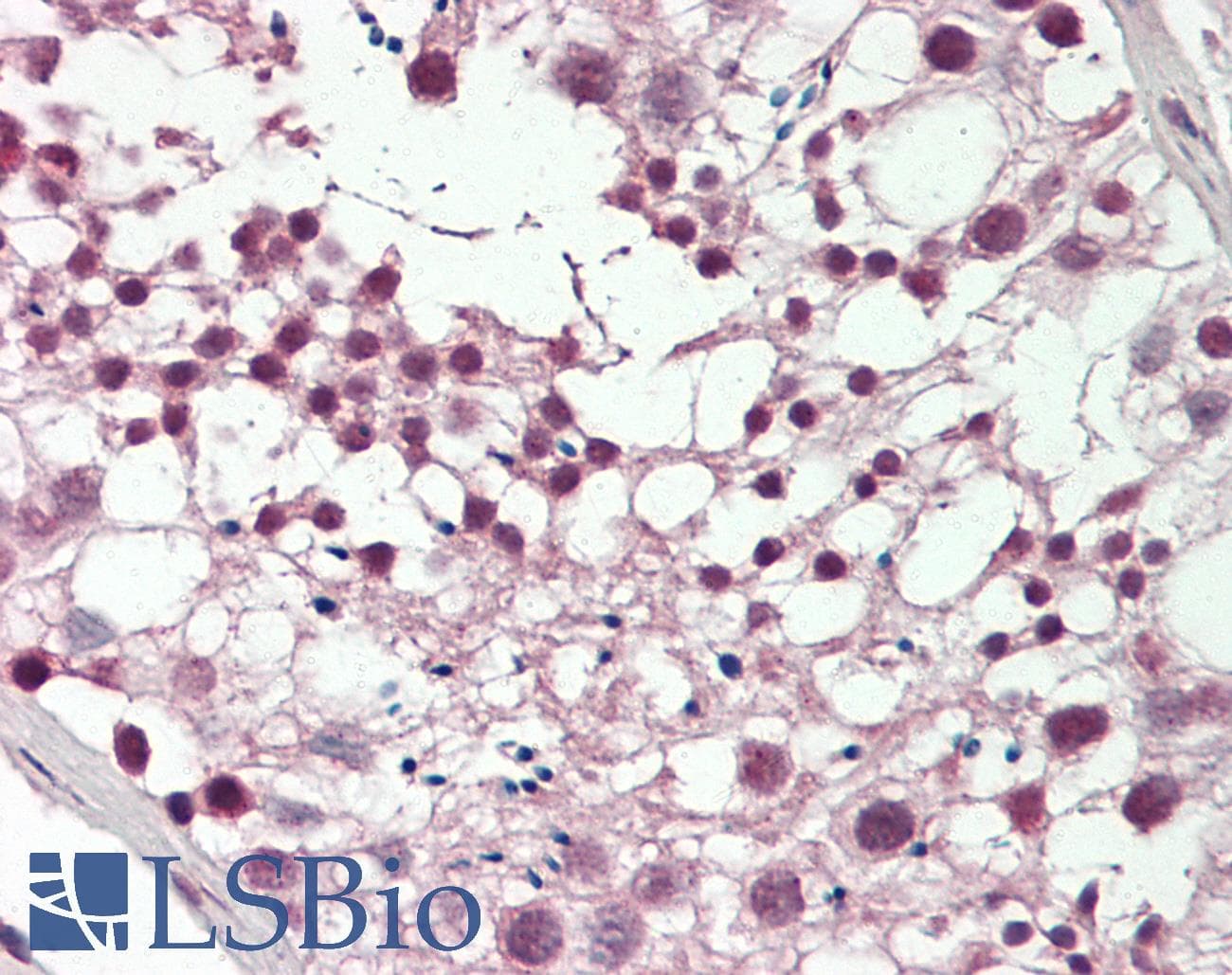 IHC-plus™ KPNB1 / Importin Beta Antibody (aa190-216)