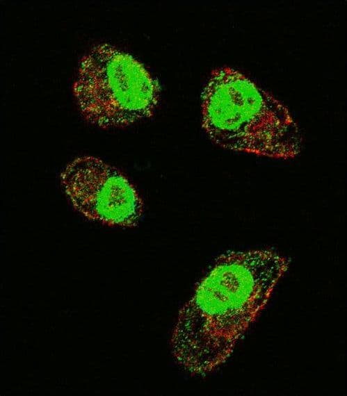 HIF1A / HIF1 Alpha Antibody (aa519-547)