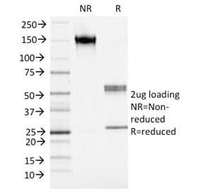 S100A4 / FSP1 Antibody (clone S100A4/1482)