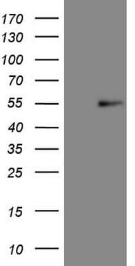 NR5A1 / SF1 Antibody (aa1-262, clone OTI1H2)