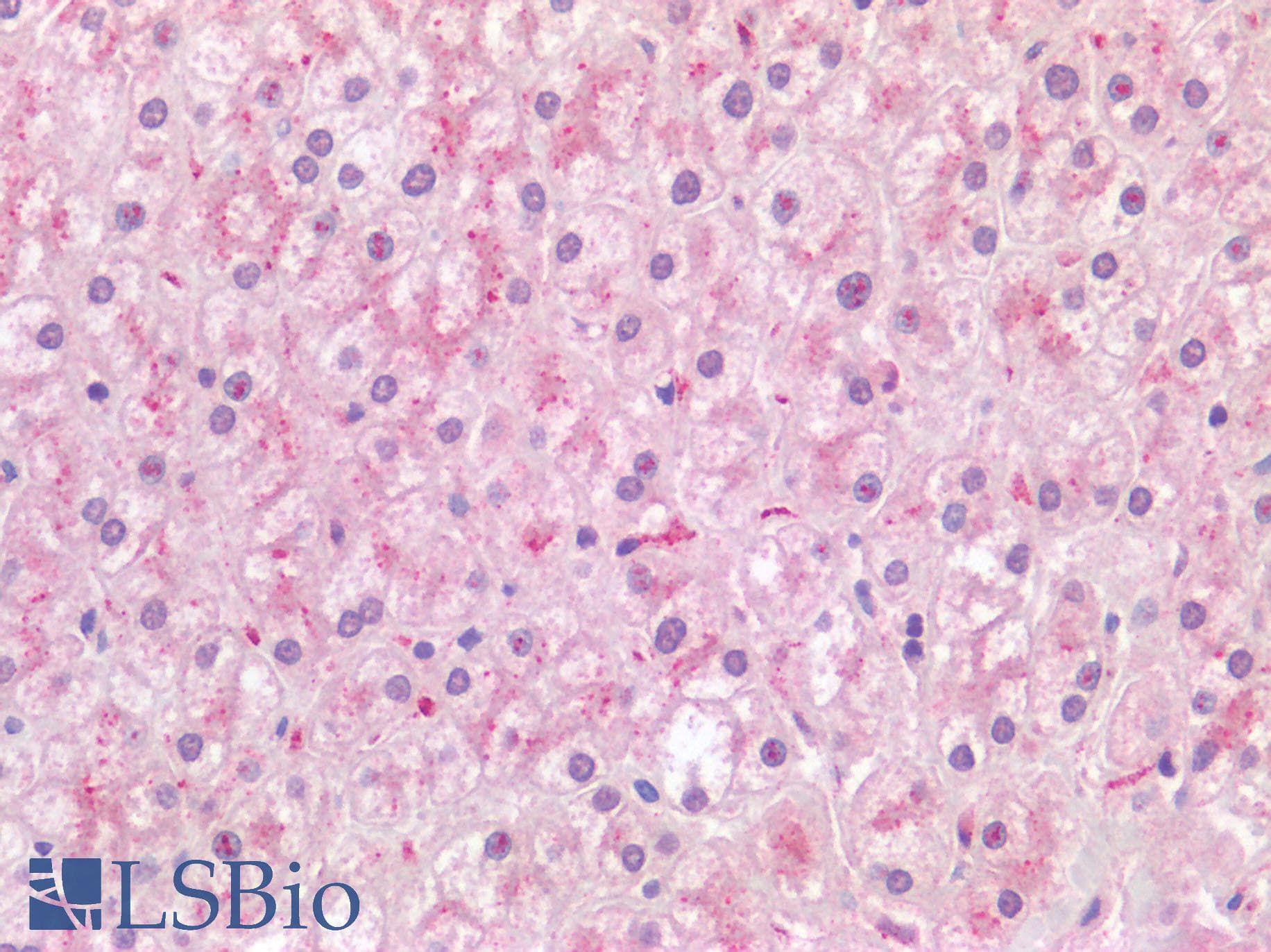 IHC-plus™ Polyclonal Rabbit anti-Human CTSL / Cathepsin L Antibody (IHC)