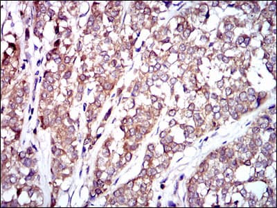 Monoclonal Mouse anti-Human RAF1 / RAF Antibody (clone 4G4, IHC, WB)