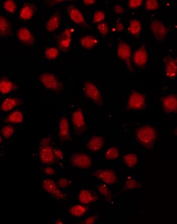 RPA2 / RFA2 / RPA34 Antibody (phospho-Thr21)