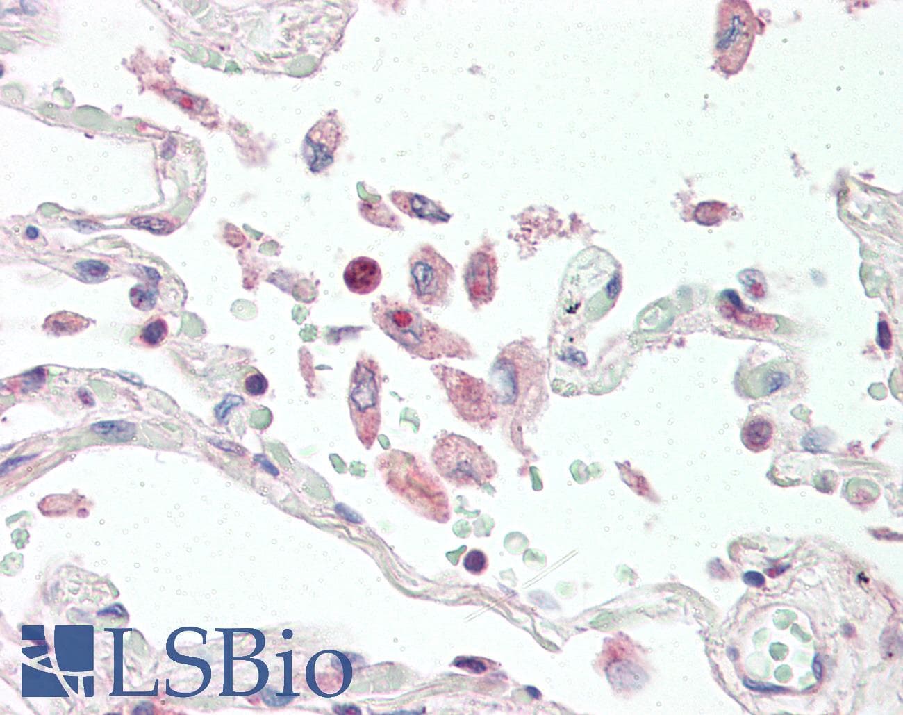 IHC-plus™ Polyclonal Rabbit anti-Human TNFSF13 / APRIL Antibody (IHC, WB)