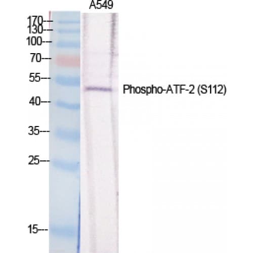 ATF2 Antibody (50-130 aa)
