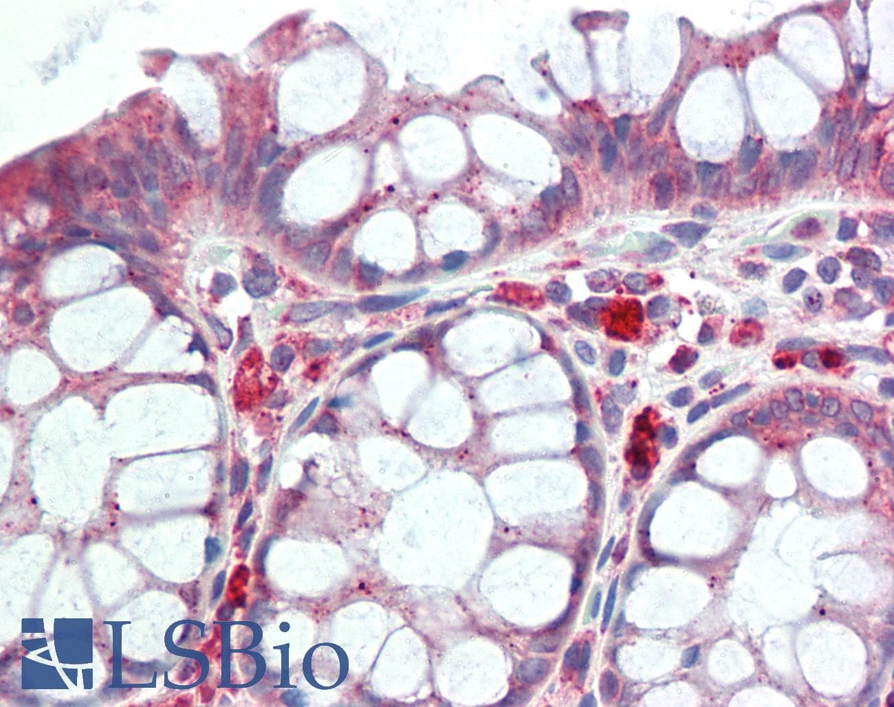 GPNMB / Osteoactivin Antibody (aa50-99)