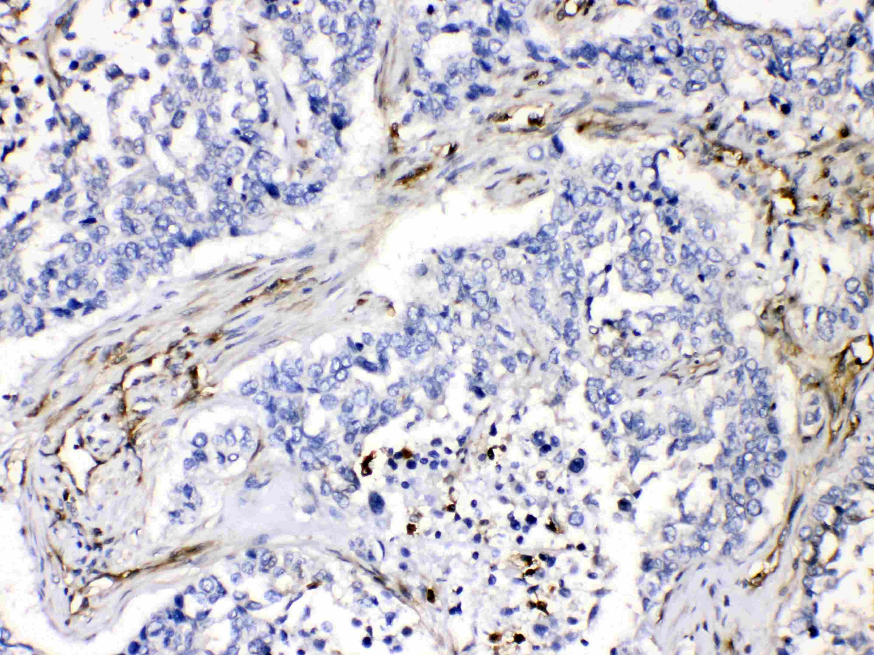 VASP Antibody