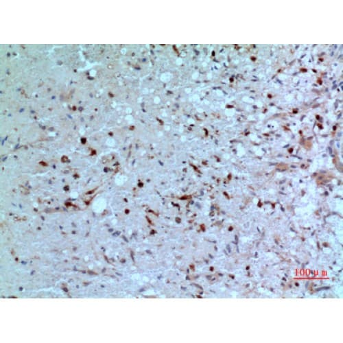 TP / Thymidine Phosphorylase Antibody (1-50 aa, N-terminal)