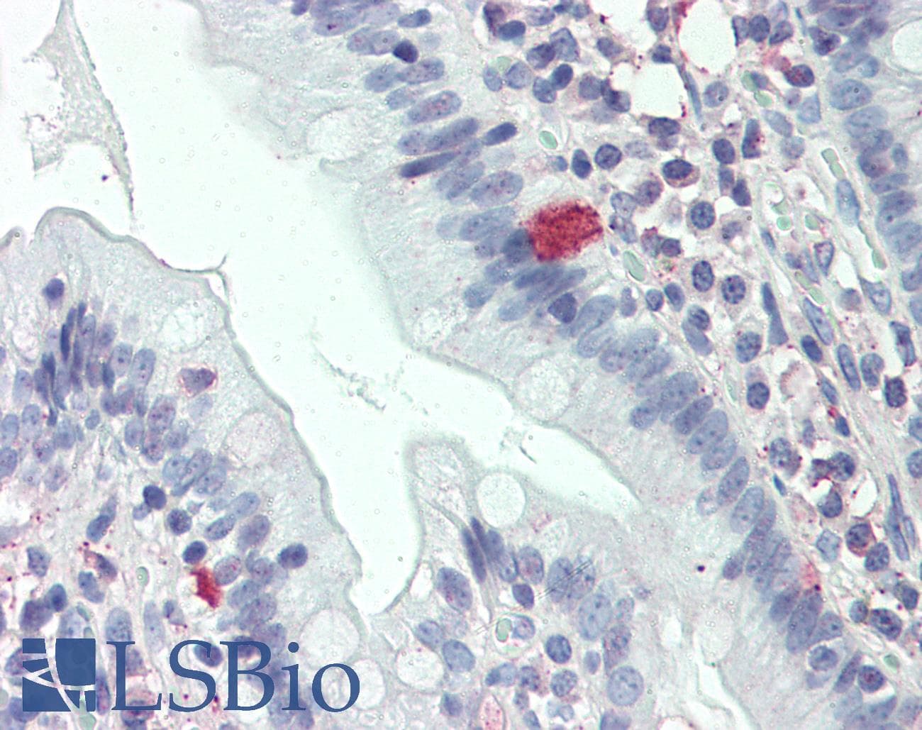 IHC-plus™ THEM6 / C8orf55 Antibody (Internal)