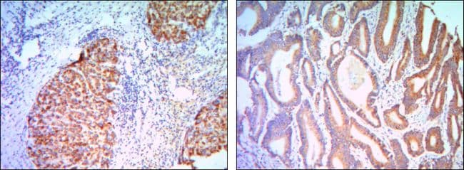 Monoclonal Mouse anti-Human KLHL11 Antibody (clone 1B9C1, IHC, IF, WB)