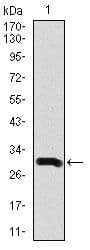 Monoclonal Mouse anti-Human DCX / Doublecortin Antibody (clone 2G5, Amino Acid: 362-411, IHC, IF, WB)