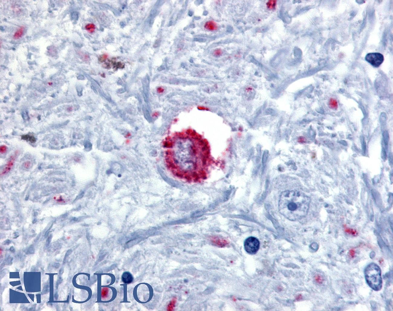 IHC-plus™ Polyclonal Rabbit anti-Human BRS3 Antibody (C-Terminus, IHC)