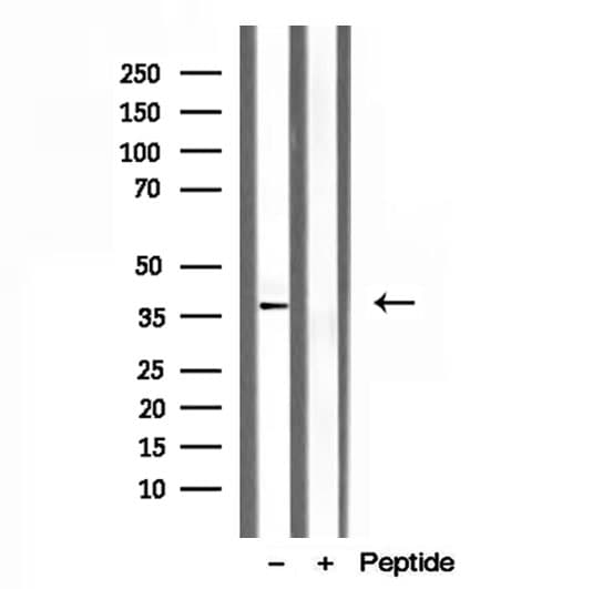 Polyclonal Rabbit anti-Human CLTA / LCA Antibody (IHC, WB)