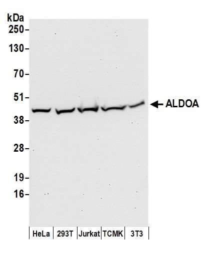 ALDOA / Aldolase A Antibody (aa50-100)